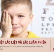 Phân biệt mắt lác liệt và lác luân phiên? Các phương pháp chữa lác hiệu quả